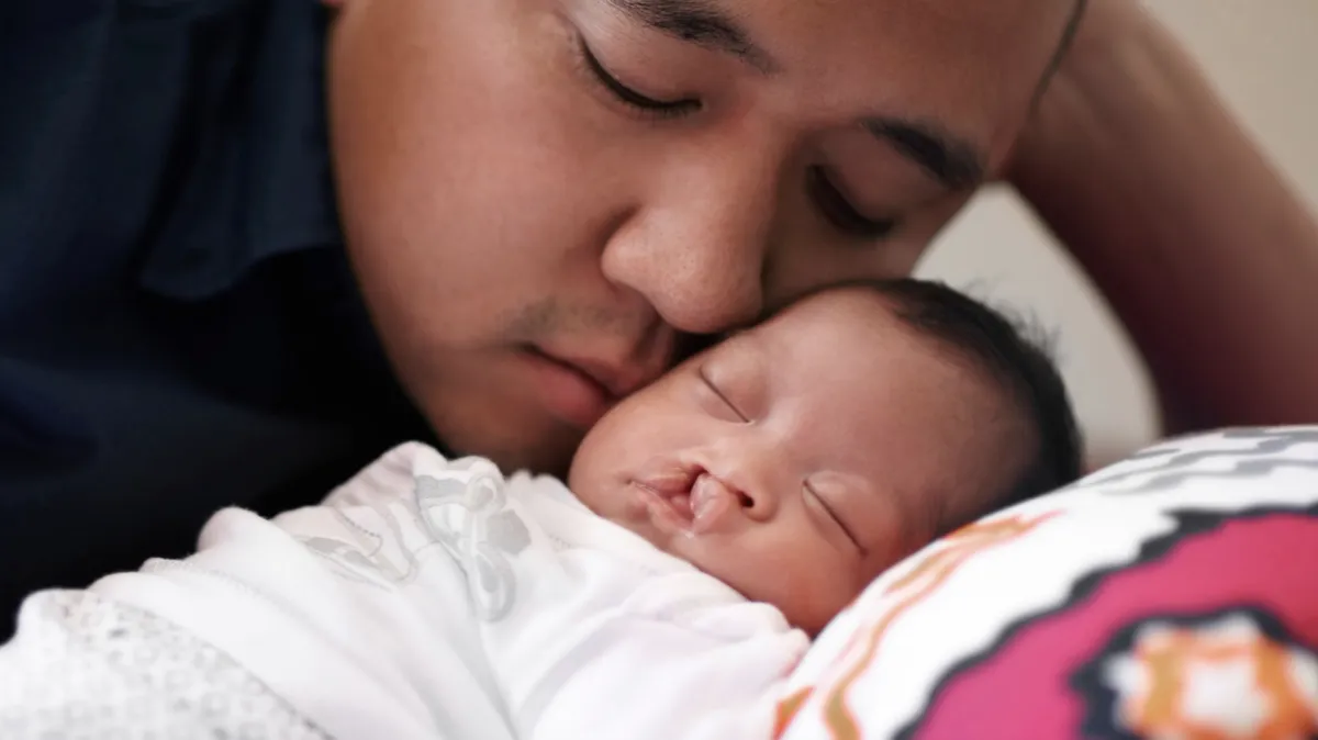 Rázštep pery a podnebia (cheilognatopalatoschisis)