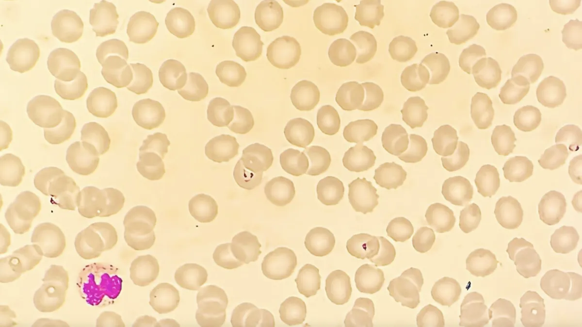 Cyklická neutropénia