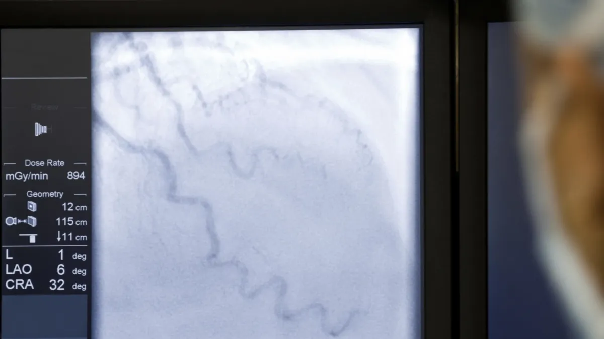 Angiografia