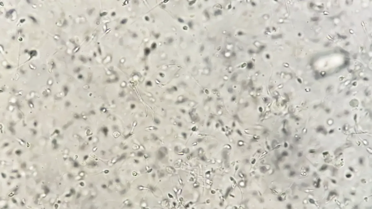 Spermiogram