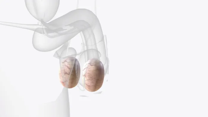 Kryptorchizmus (nezostúpenie semenníkov)