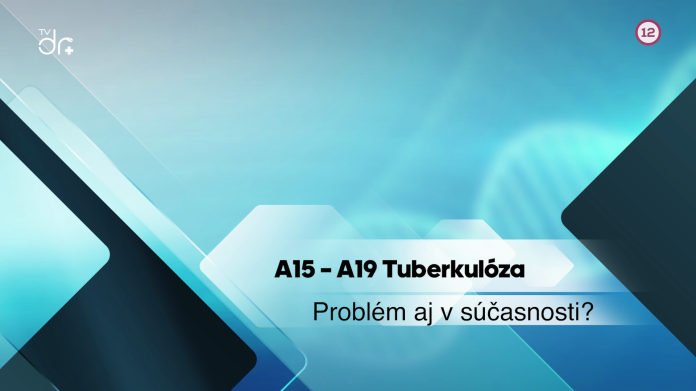 A15 - A19 Tuberkulóza