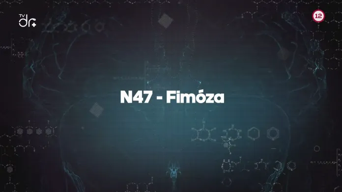 N47 Fimóza