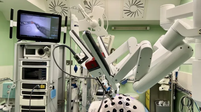Robotická chirurgia
