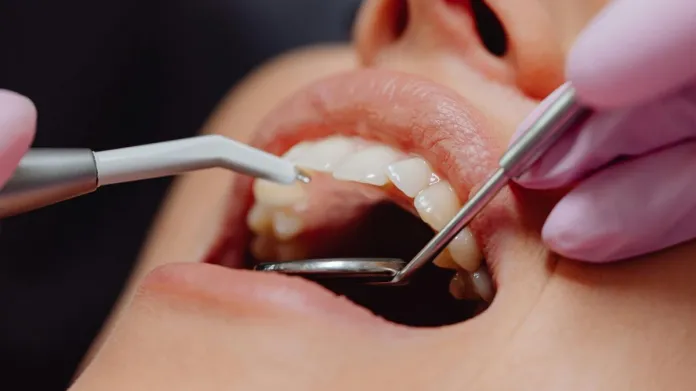Dentálna hygiena